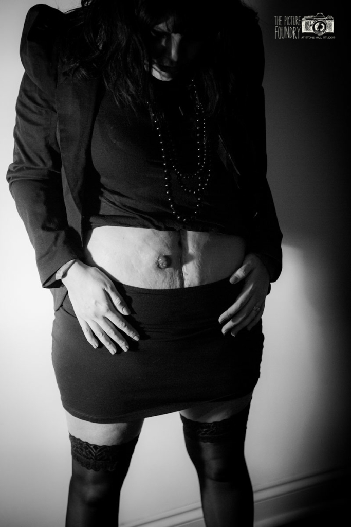 stoma ileostomy femininity #stomaselfie stoma ileostomy femininity black and white photography creative shoot