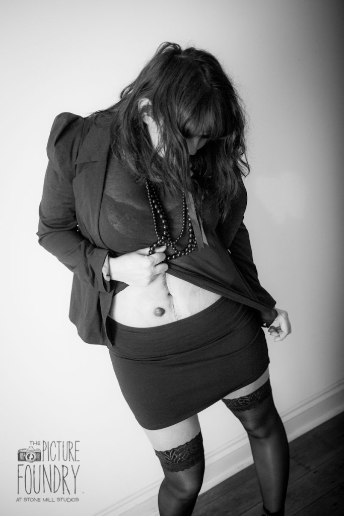 stoma ileostomy femininity black and white photography creative shoot